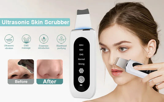 My World Of Beauty™ Ultrasonic Skin Scrubber