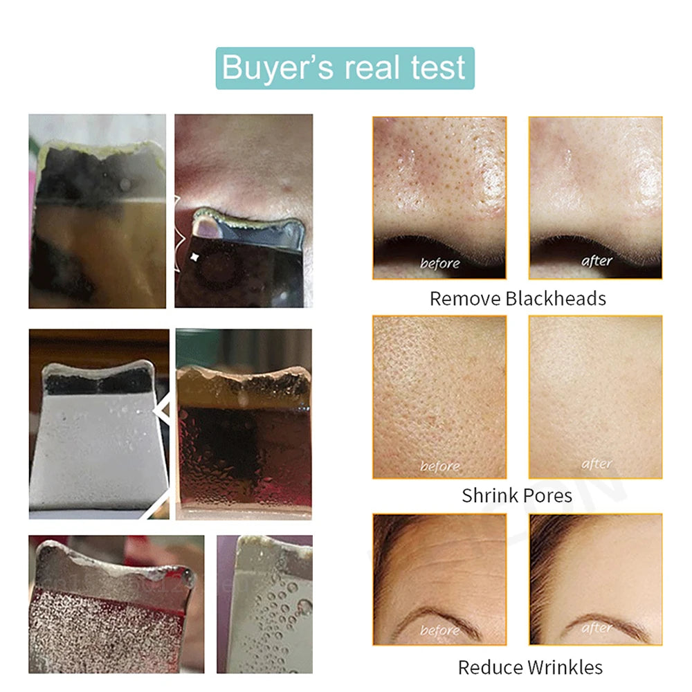 My World Of Beauty™ Ultrasonic Skin Scrubber