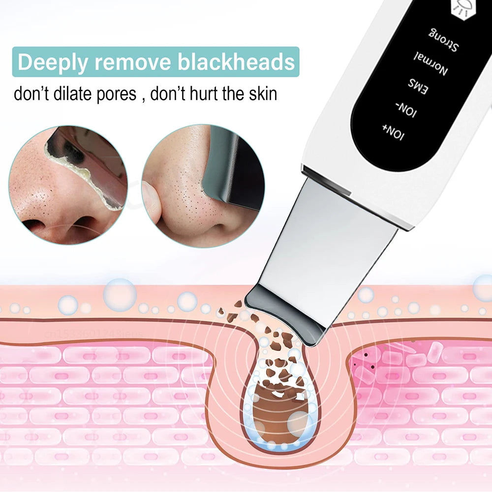 My World Of Beauty™ Ultrasonic Skin Scrubber