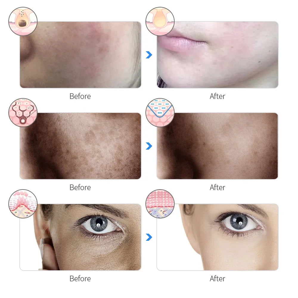 My World Of Beauty™  Rechargeable Facial LED Mask 7